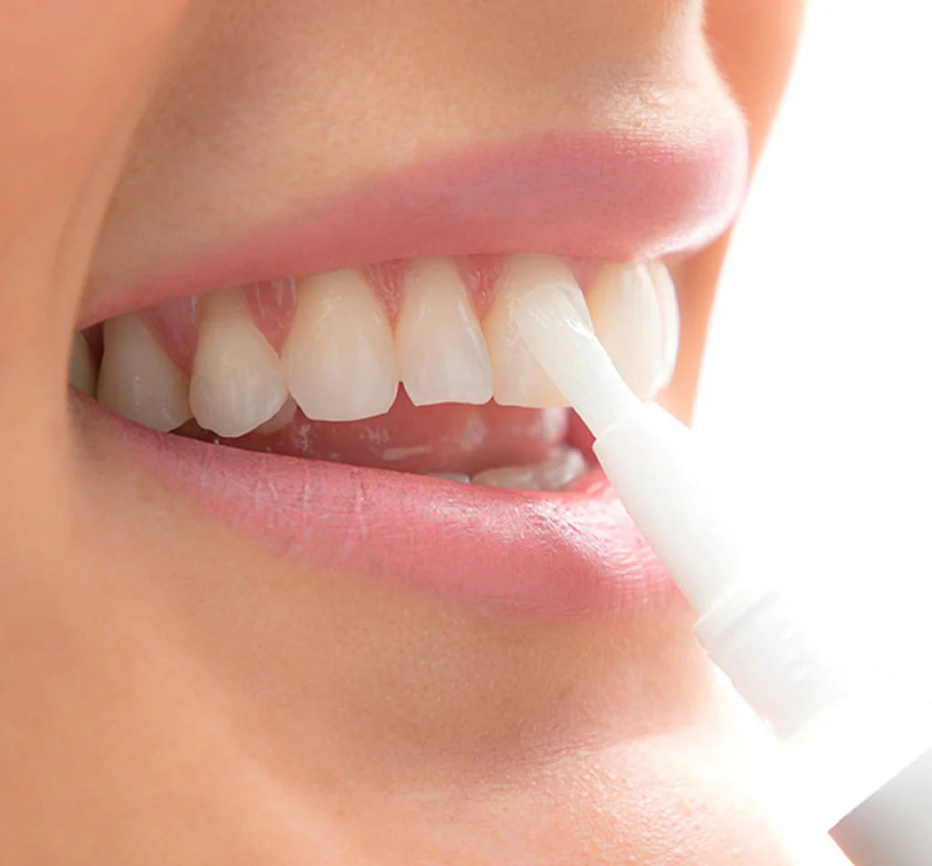 LÁPIZ PRO - BLANQUEADOR DENTAL ,SONRÍE CON SEGURIDAD